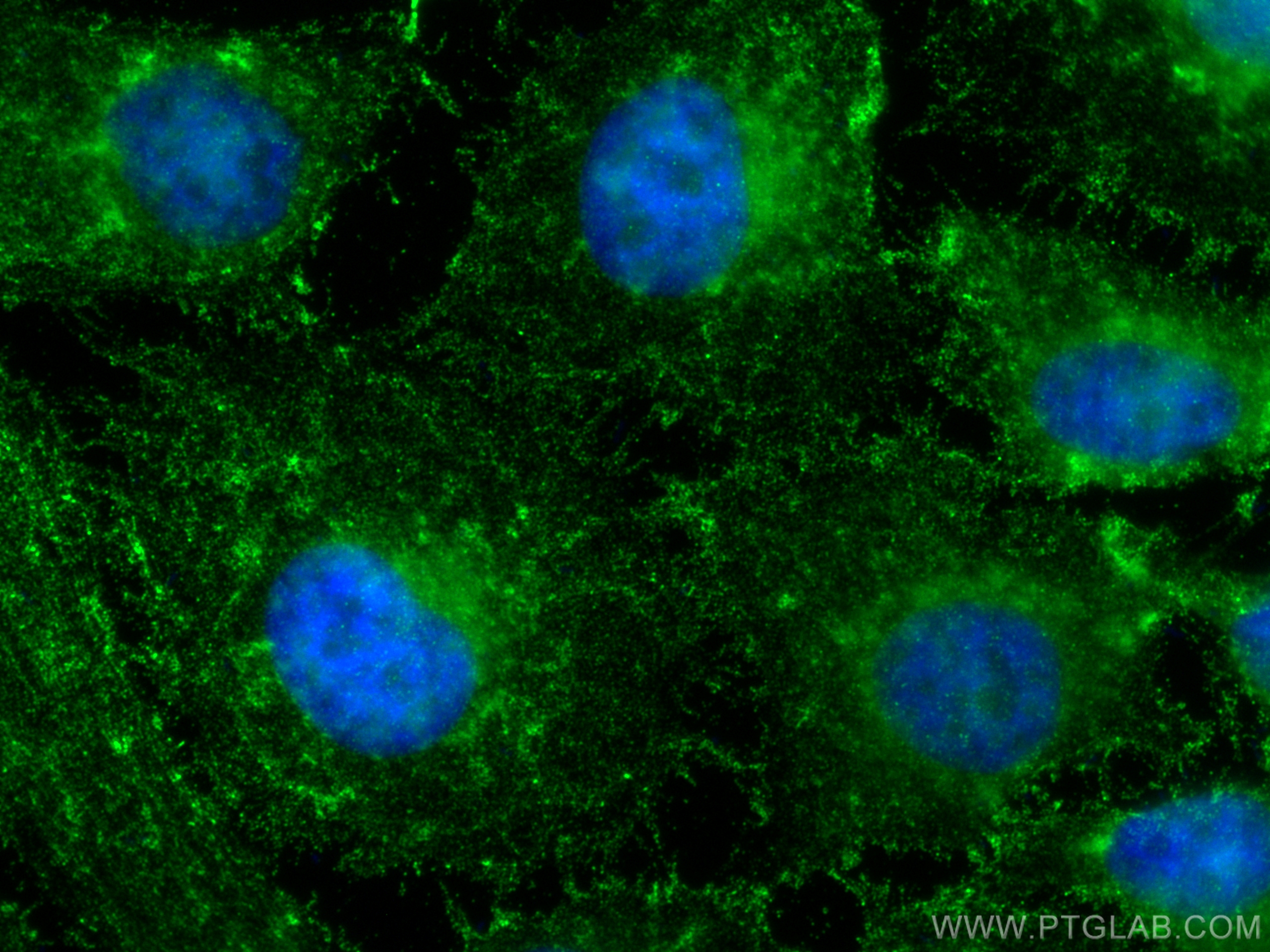 Immunofluorescence (IF) / fluorescent staining of HeLa cells using Bcl-XL Monoclonal antibody (66020-1-Ig)