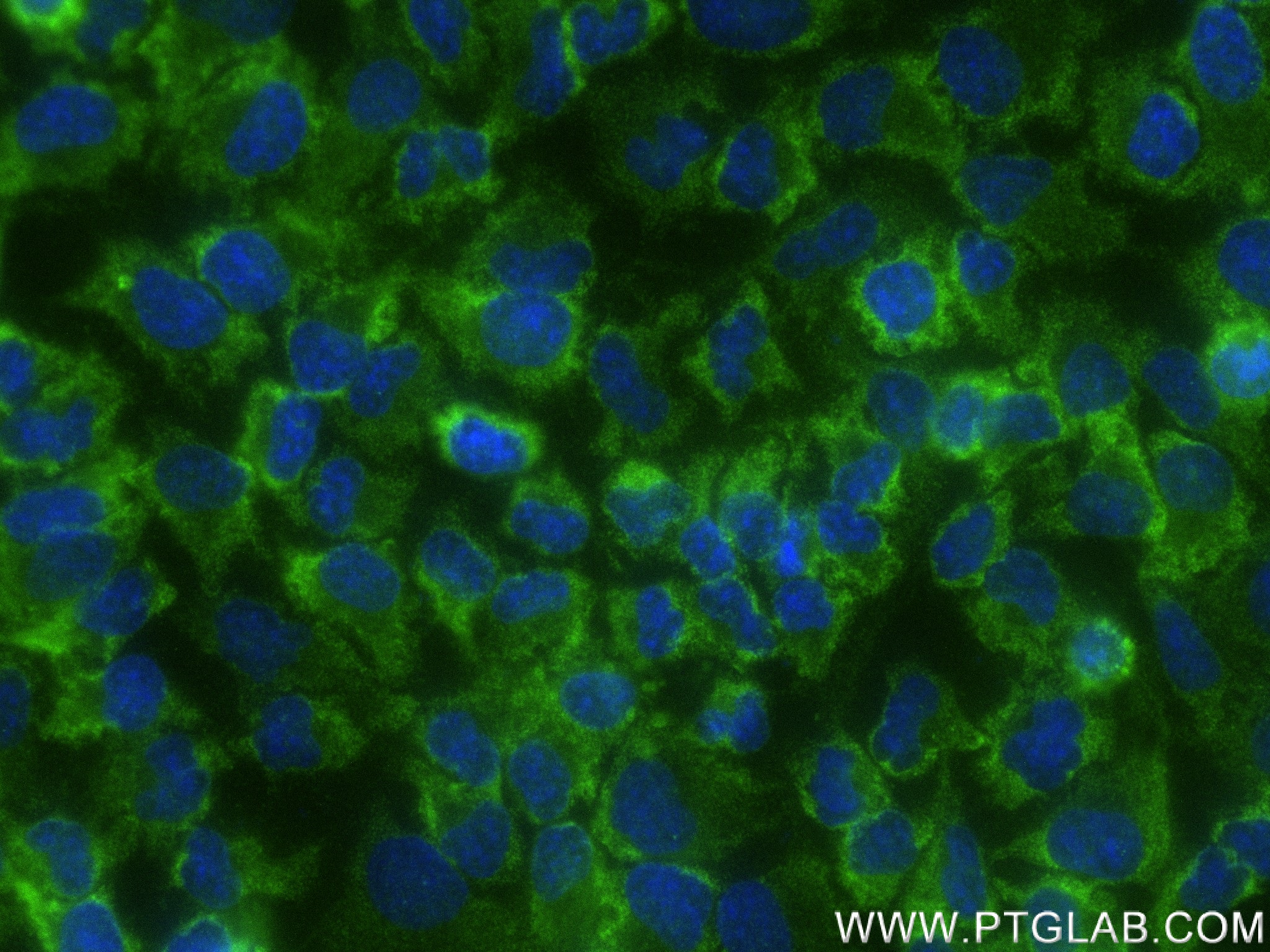 Immunofluorescence (IF) / fluorescent staining of HeLa cells using Bcl-xL Recombinant antibody (83330-2-RR)