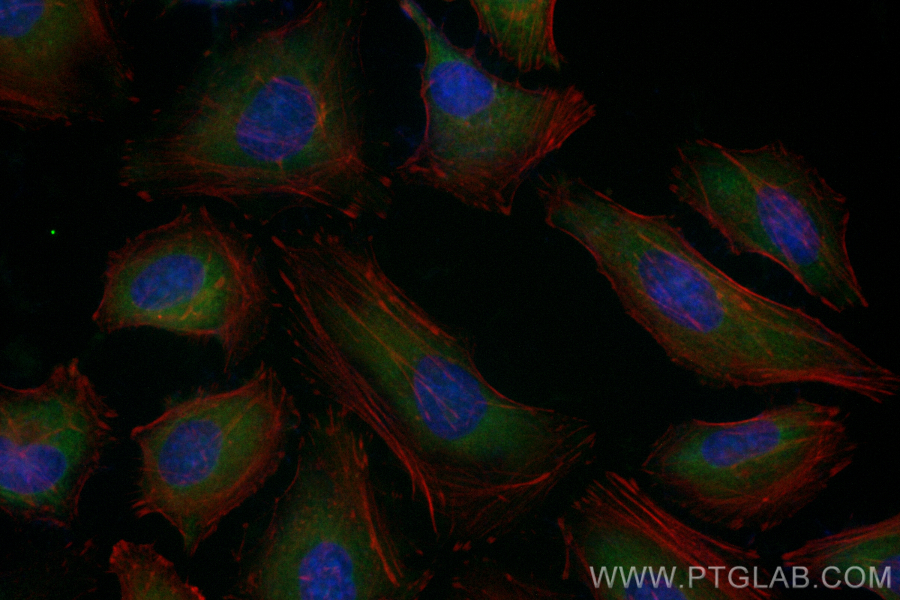 Immunofluorescence (IF) / fluorescent staining of HeLa cells using CoraLite® Plus 488-conjugated Bcl-xL Recombinant a (CL488-83330-2)