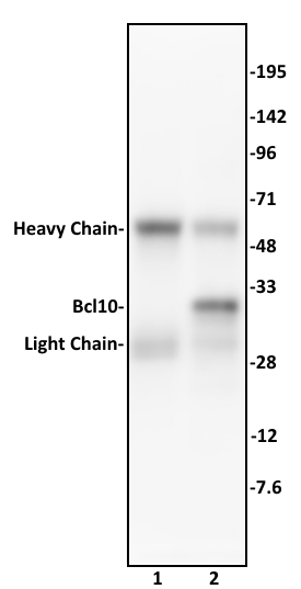 Bcl10 antibody (mAb) (Clone 151) tested by Immunoprecipitation. 10 ug of Bcl10 antibody was used to immunoprecipitate Bcl10 from 500 ug of K562 whole cell extract (lane 2). 10 ug of mouse IgG was used as a negative control (lane 1). The immunoprecipitated protein was detected by Western blotting using the Bcl10 antibody at a 1 ug/ml dilution.