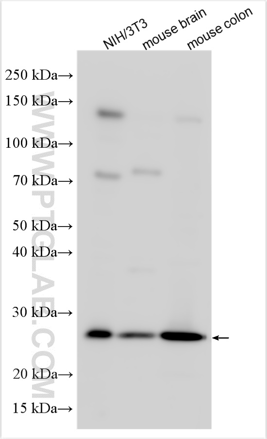 Western Blot (WB) analysis of various lysates using Bcl2 Polyclonal antibody (26593-1-AP)