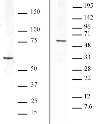 Bcl3 antibody tested by Western blot. Detection of Bcl3 by Western blot analysis. Lane 1: HeLa whole-cell extract (20 ug). Lane 2: Nuclear extract (20 ug) of Raji cells. Both probed with Bcl3 antibody at a dilution of 1:1,000.