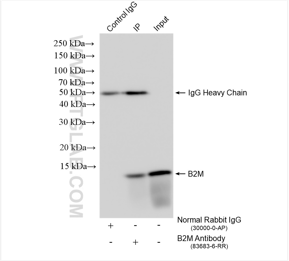 Immunoprecipitation (IP) experiment of A431 cells using Beta-2-Microglobulin Recombinant antibody (83683-6-RR)