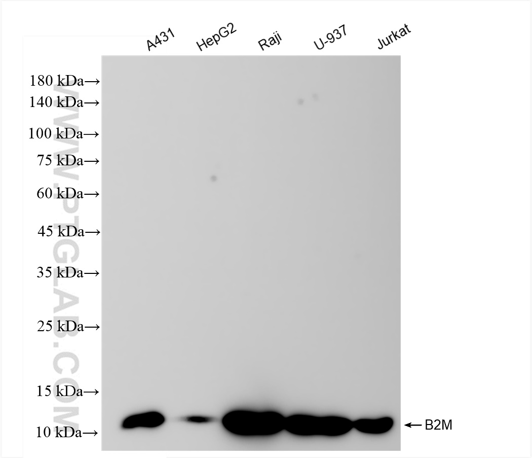 Western Blot (WB) analysis of various lysates using Beta-2-Microglobulin Recombinant antibody (83683-6-RR)