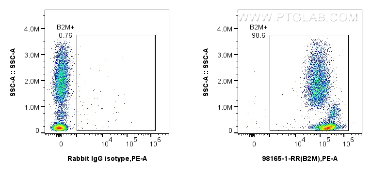 Beta-2-Microglobulin