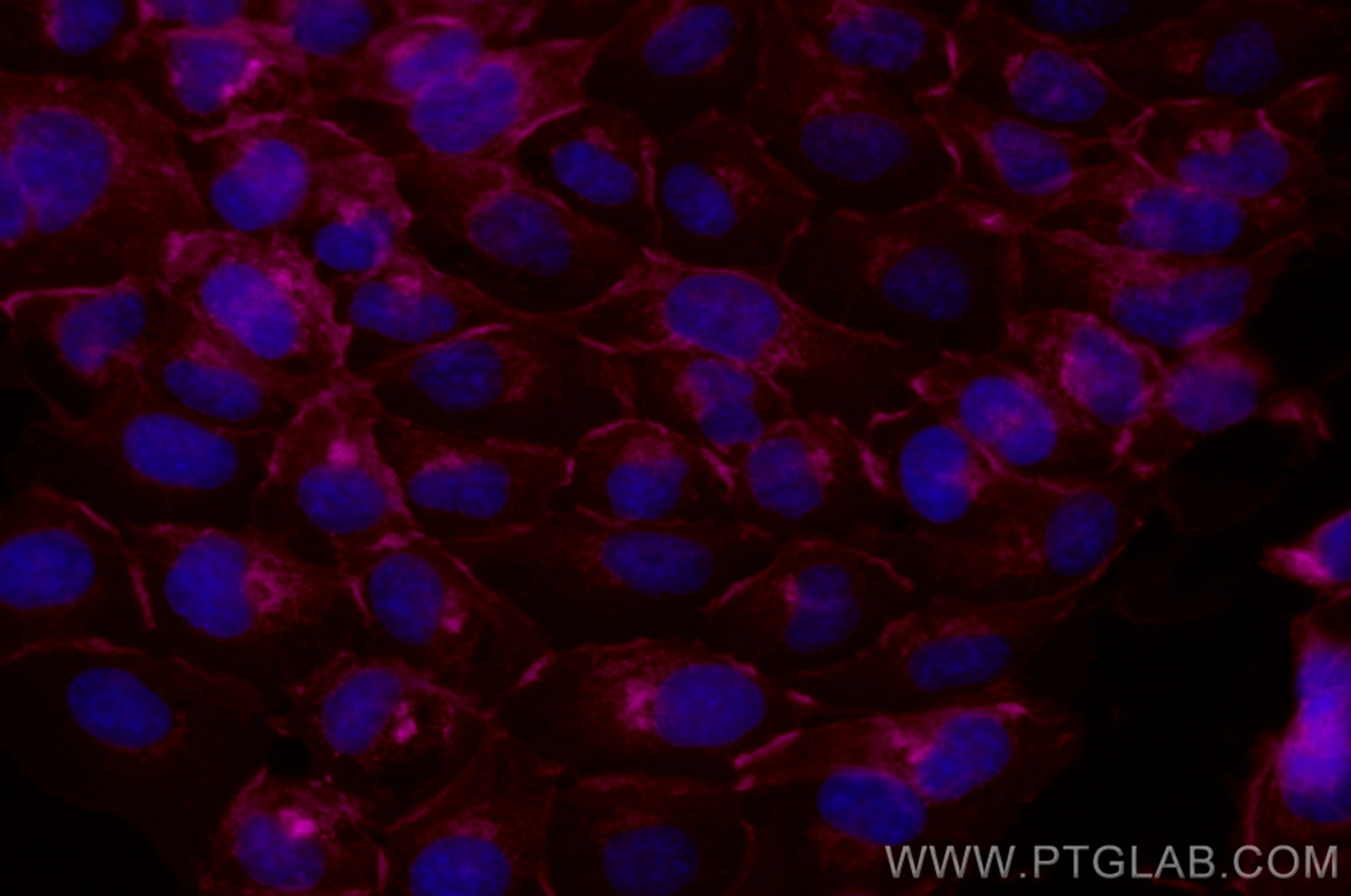 Immunofluorescence (IF) / fluorescent staining of A431 cells using CoraLite® Plus 647-conjugated Beta-2-Microglobulin (CL647-13511)