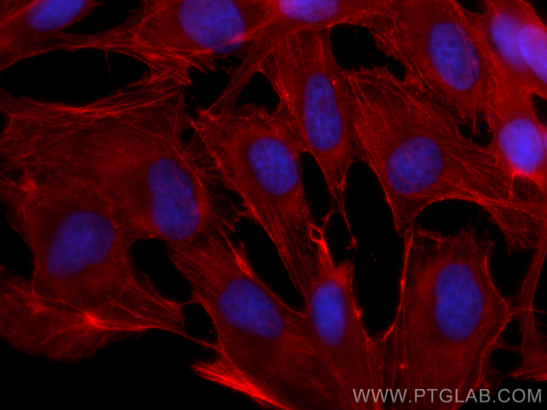 Immunofluorescence (IF) / fluorescent staining of MDCK cells using CoraLite®594-conjugated Beta Actin Recombinant ant (CL594-81115)