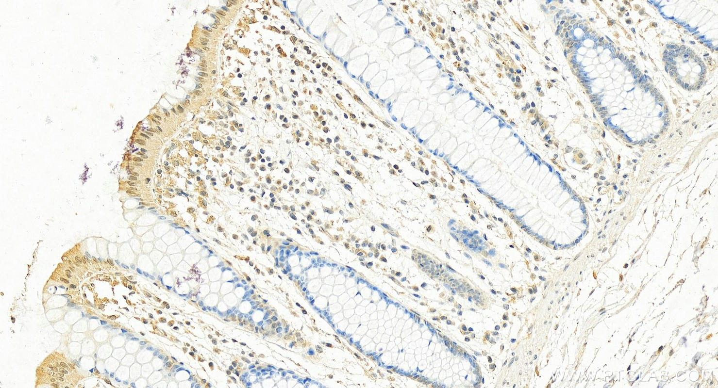 Immunohistochemistry (IHC) staining of human colon tissue using Beta Arrestin 2 Monoclonal antibody (68502-1-Ig)