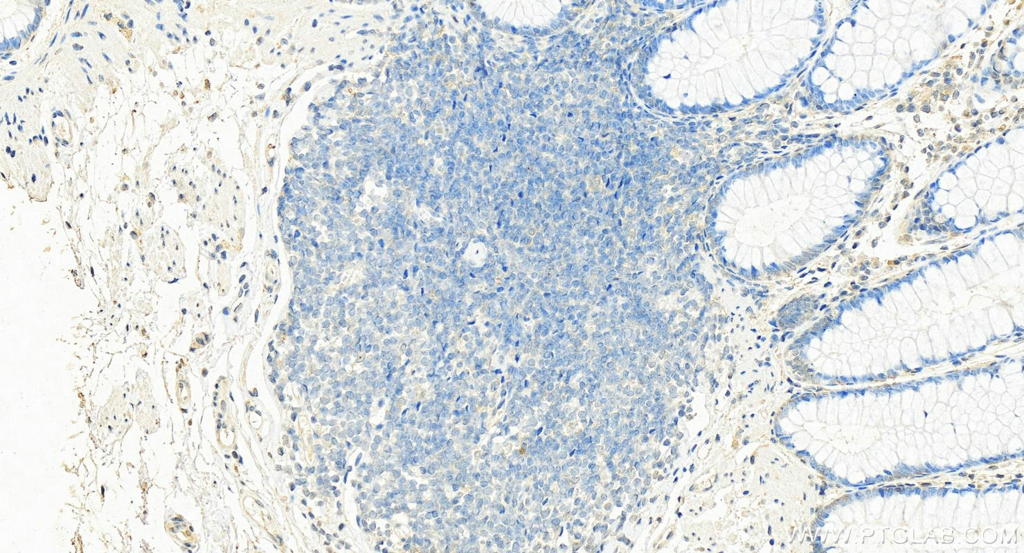 Immunohistochemistry (IHC) staining of human colon tissue using Beta Arrestin 2 Monoclonal antibody (68502-1-Ig)