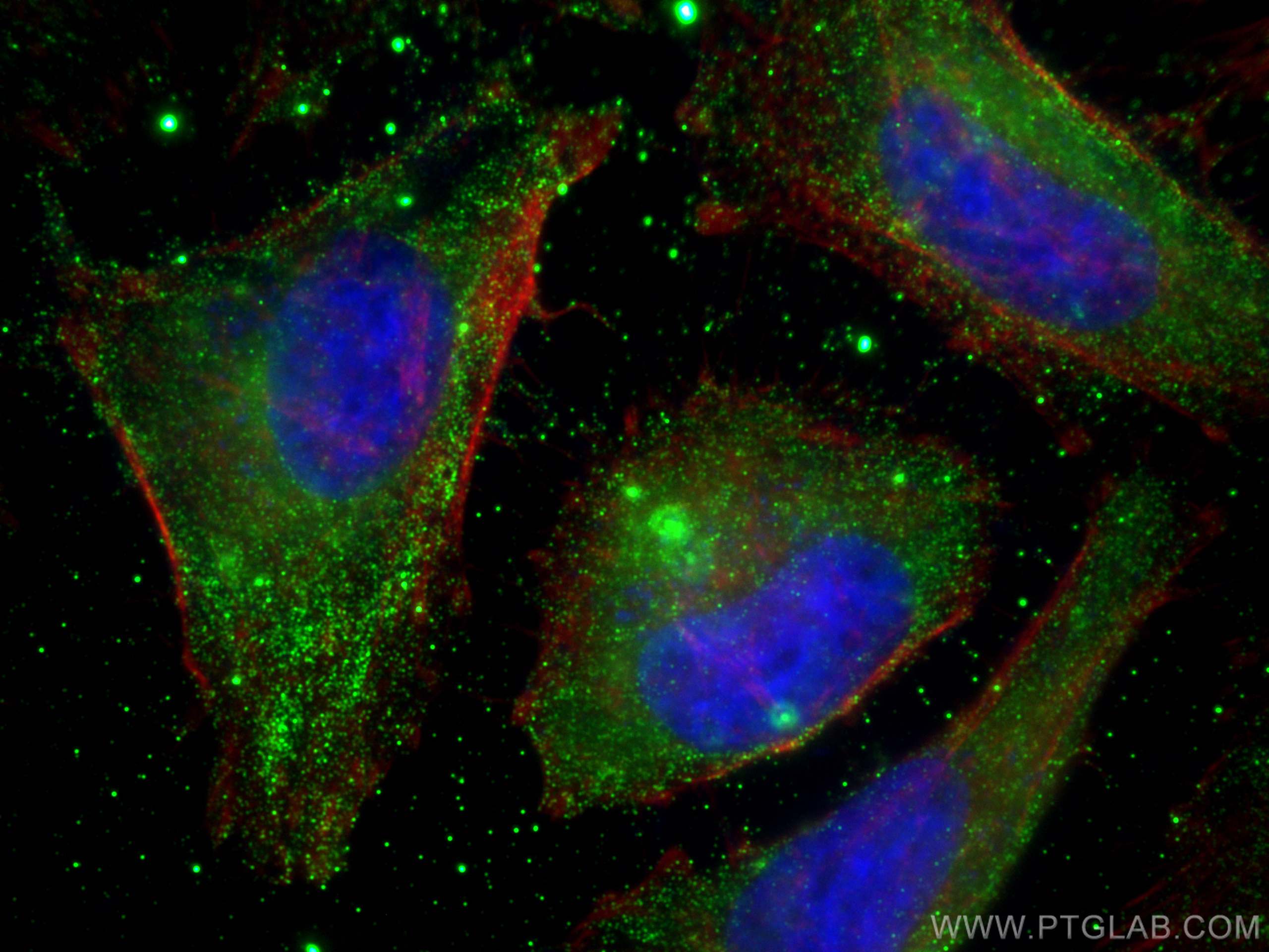 Immunofluorescence (IF) / fluorescent staining of HeLa cells using Beta Arrestin 2 Monoclonal antibody (68502-1-Ig)