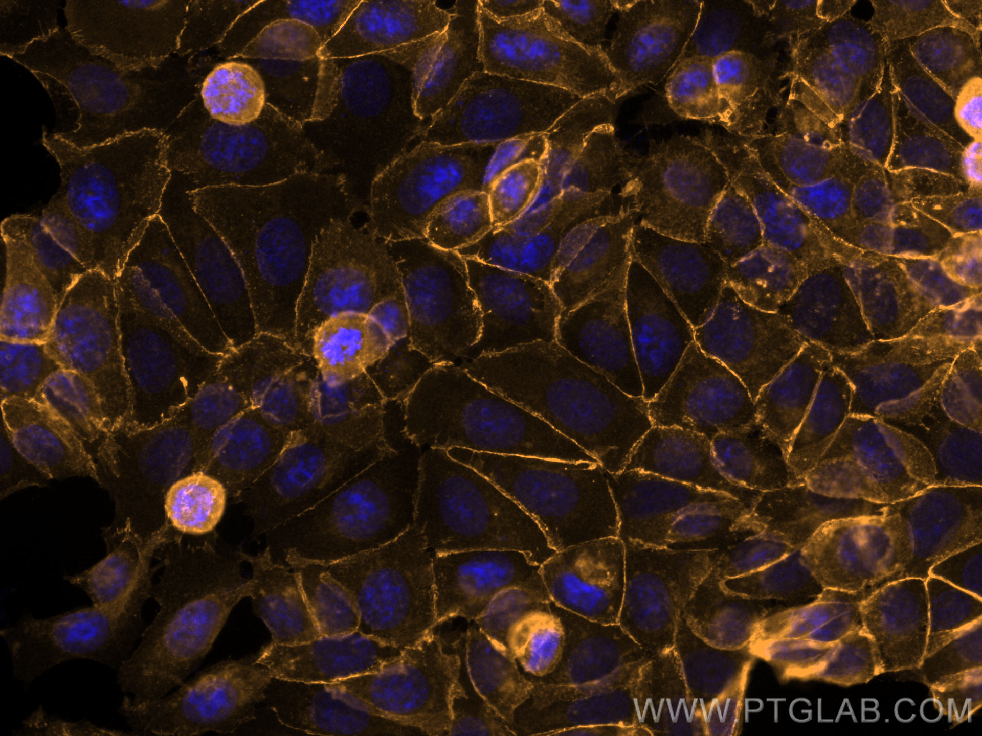 Immunofluorescence (IF) / fluorescent staining of MCF-7 cells using CoraLite®555-conjugated Beta Catenin Polyclonal an (CL555-51067)