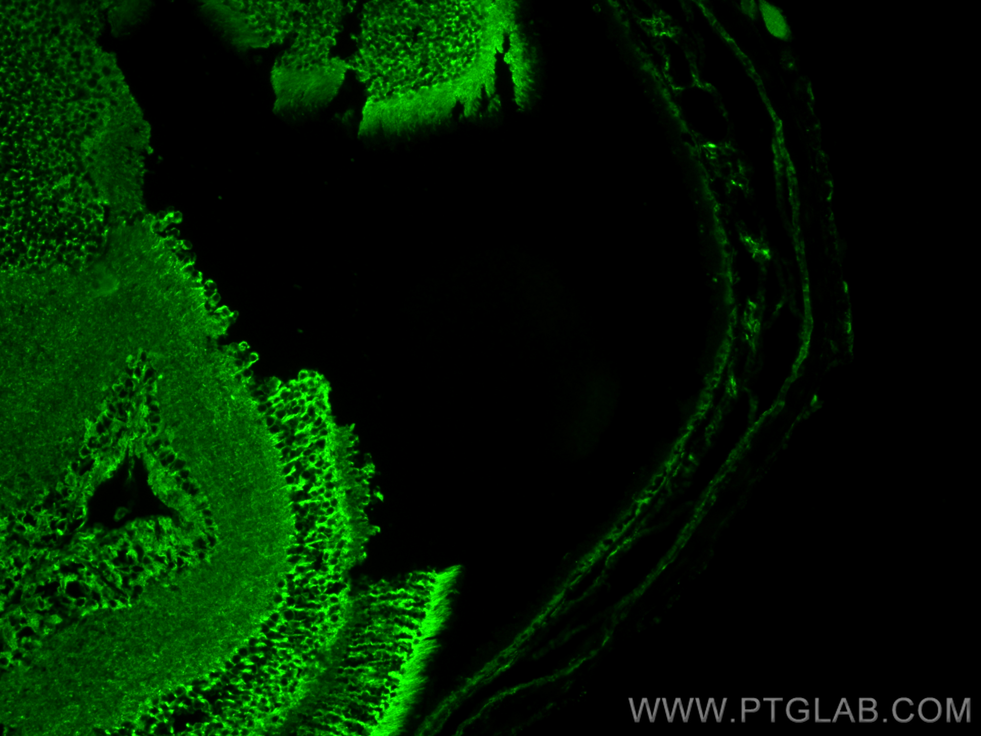 Immunofluorescence (IF) / fluorescent staining of mouse eye tissue using Beta Tubulin Recombinant antibody (80713-1-RR)