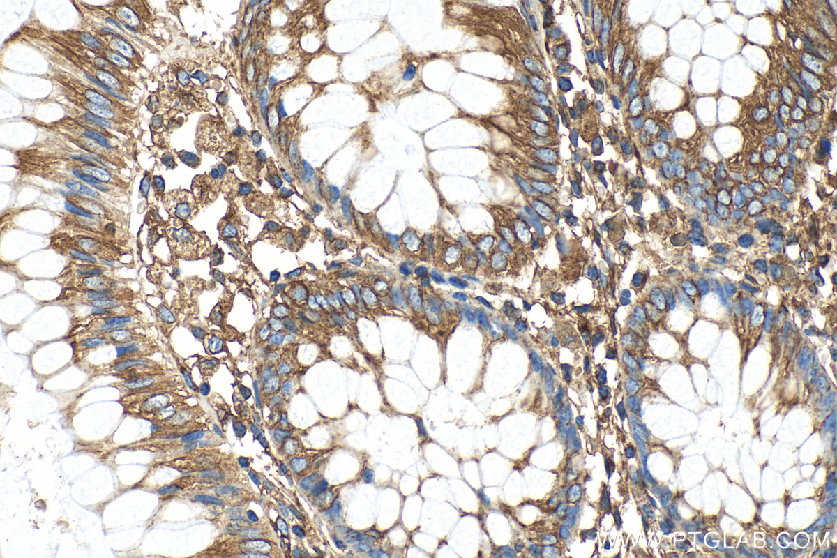 Immunohistochemistry (IHC) staining of human colon tissue using Beta Tubulin Recombinant antibody (80713-1-RR)