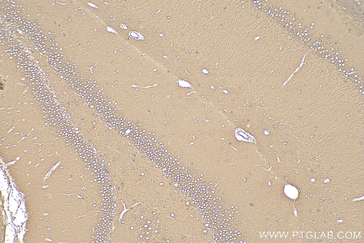 Immunohistochemistry (IHC) staining of rat brain tissue using Beta Tubulin Recombinant antibody (80713-1-RR)