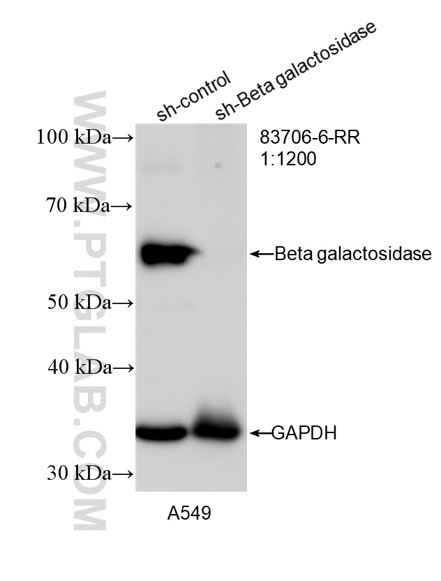 Western Blot (WB) analysis of A549 cells using Beta galactosidase Recombinant antibody (83706-6-RR)