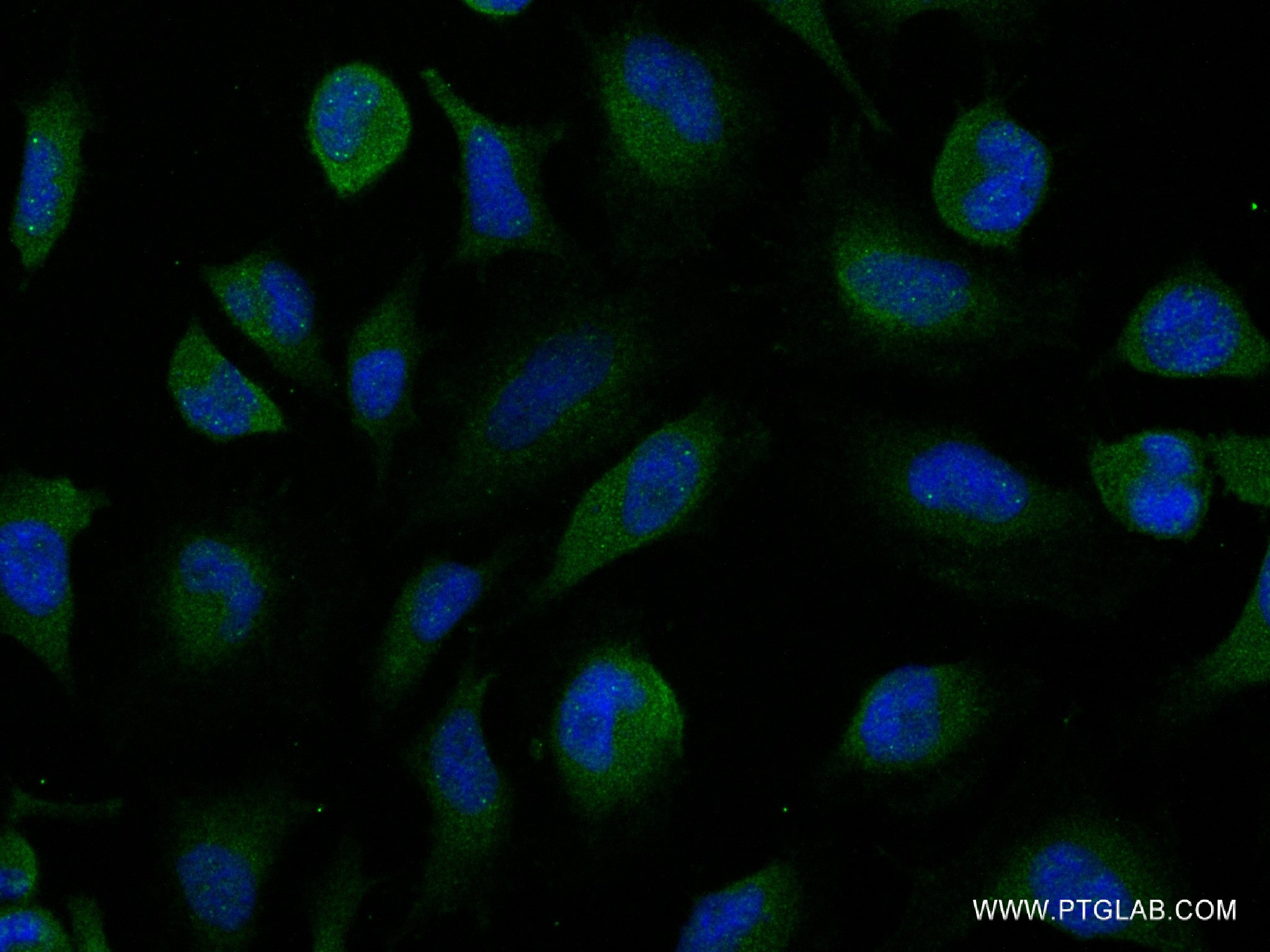 Immunofluorescence (IF) / fluorescent staining of HeLa cells using Bif-1 Recombinant antibody (83715-1-RR)