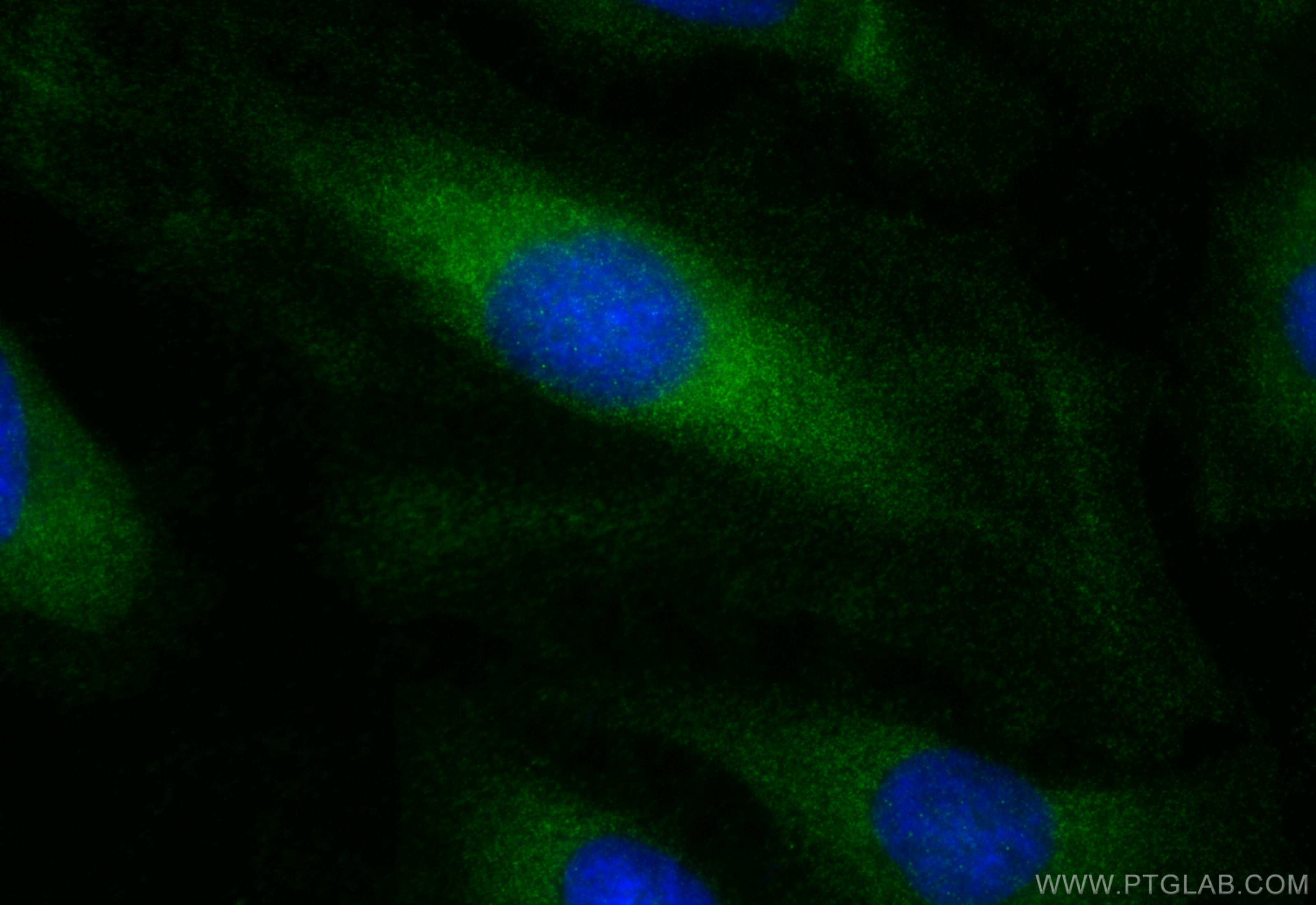 Immunofluorescence (IF) / fluorescent staining of HeLa cells using Bif-1 Recombinant antibody (83715-1-RR)