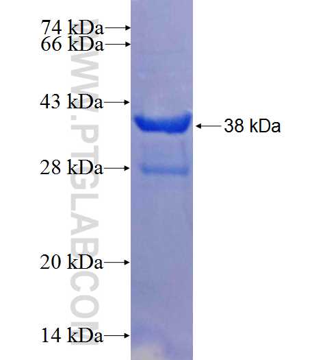 C10orf104 fusion protein Ag23641 SDS-PAGE