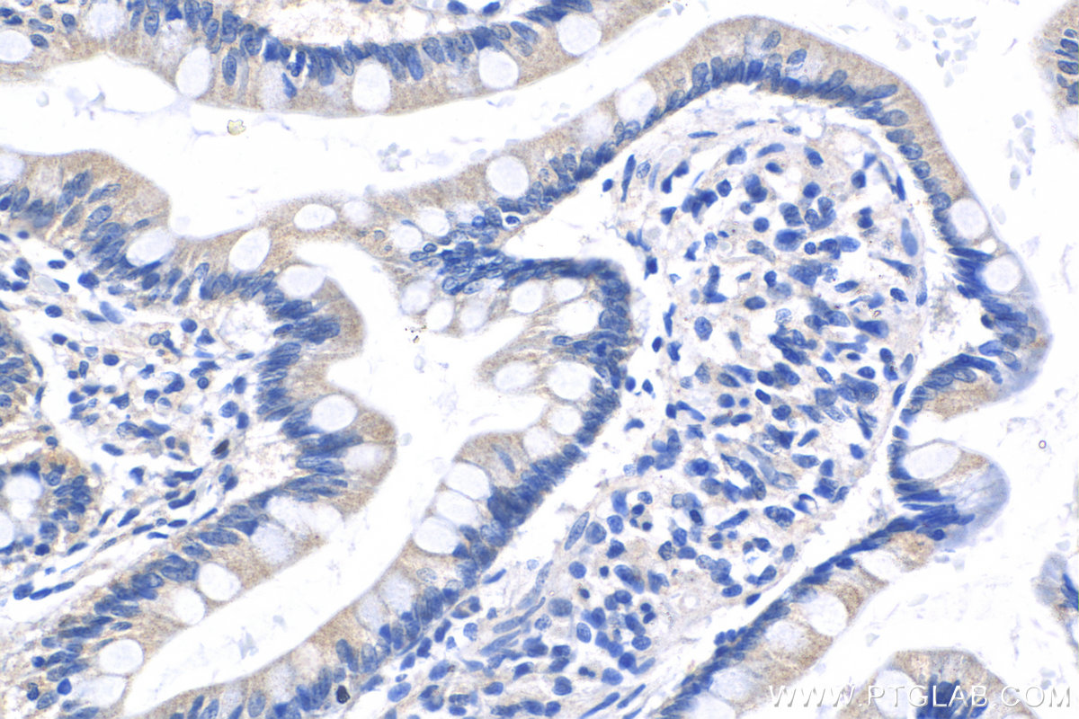 Immunohistochemistry (IHC) staining of human small intestine tissue using C10orf28 Polyclonal antibody (24967-1-AP)