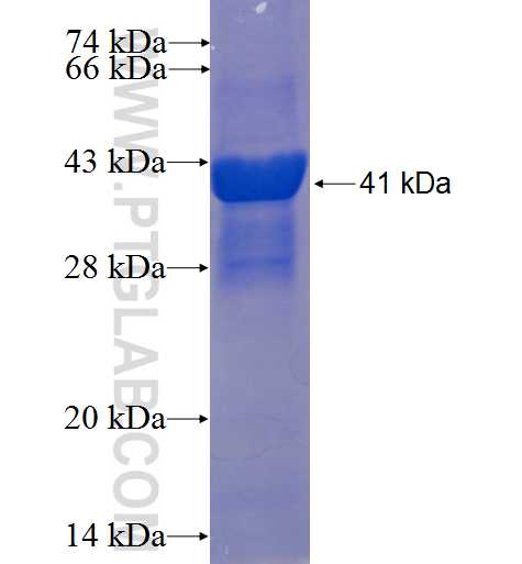 C10orf97 fusion protein Ag23520 SDS-PAGE