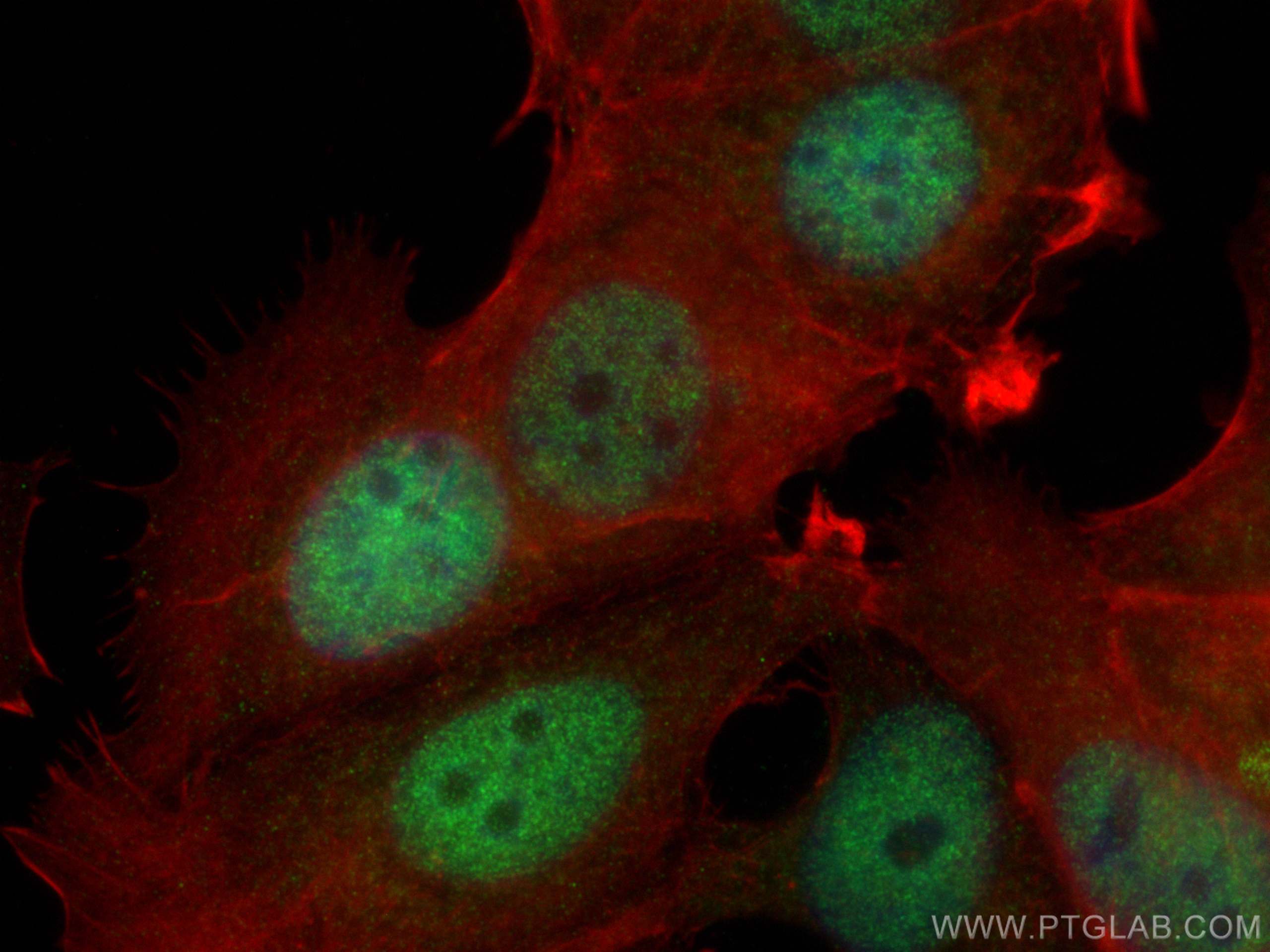 Immunofluorescence (IF) / fluorescent staining of MCF-7 cells using C11orf30 Polyclonal antibody (26212-1-AP)