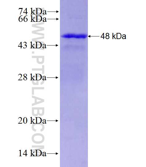 C11orf35 fusion protein Ag28088 SDS-PAGE