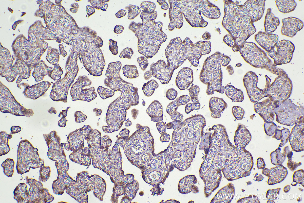 Immunohistochemistry (IHC) staining of human placenta tissue using APC15 Polyclonal antibody (20409-1-AP)