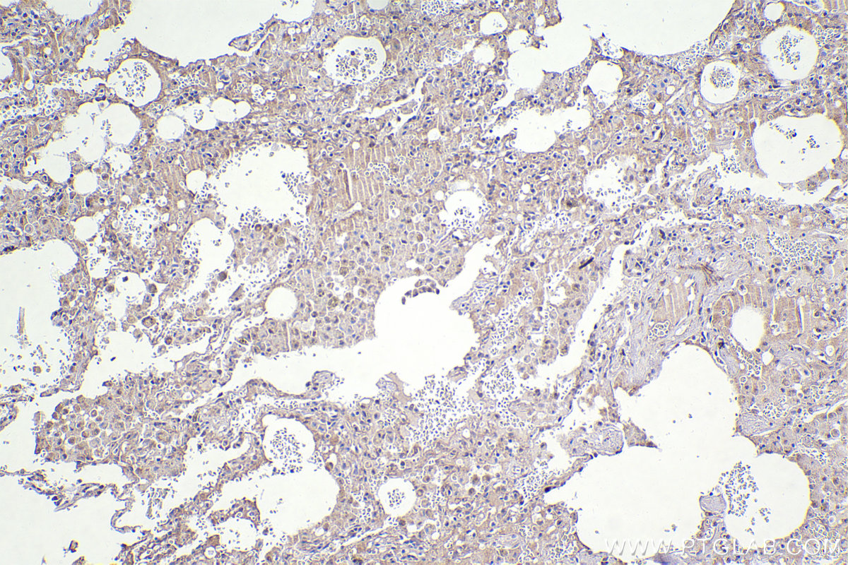 Immunohistochemistry (IHC) staining of human lung tissue using APC15 Polyclonal antibody (20409-1-AP)