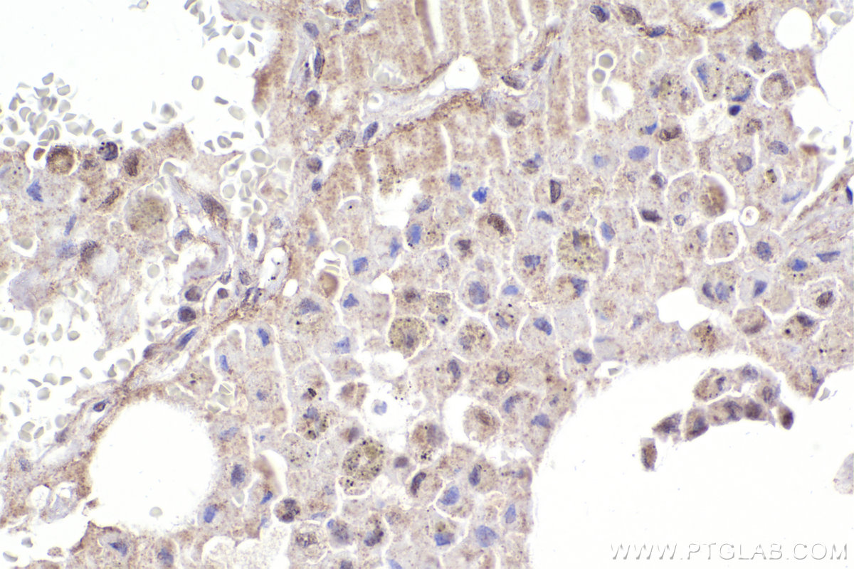 Immunohistochemistry (IHC) staining of human lung tissue using APC15 Polyclonal antibody (20409-1-AP)