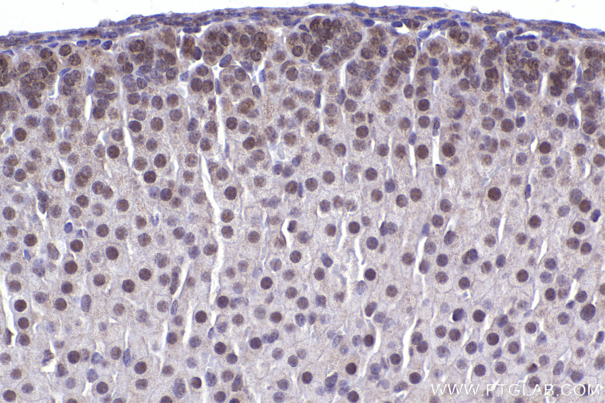 Immunohistochemistry (IHC) staining of mouse adrenal gland tissue using APC15 Polyclonal antibody (20409-1-AP)