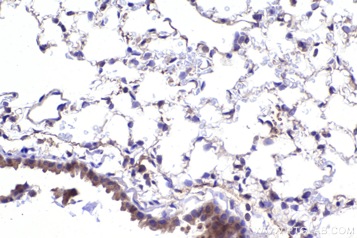 Immunohistochemistry (IHC) staining of mouse lung tissue using APC15 Polyclonal antibody (20409-1-AP)