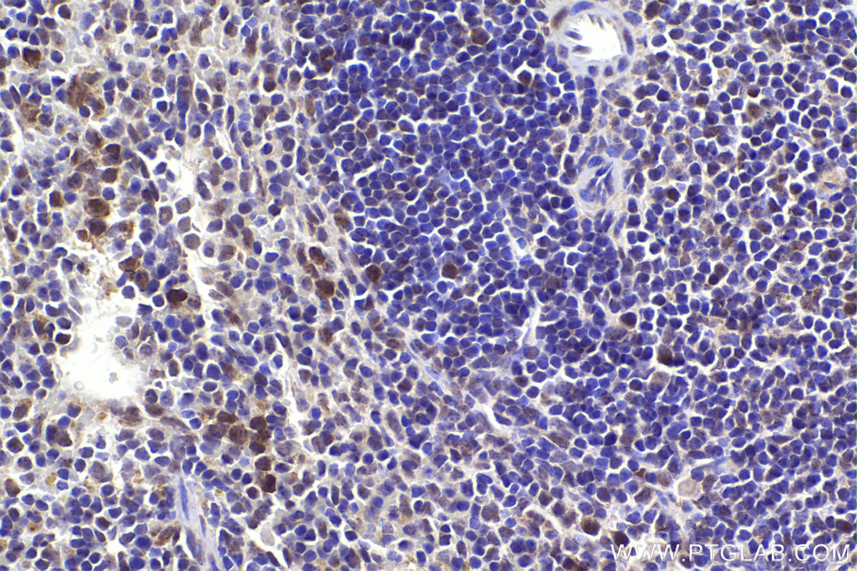 Immunohistochemistry (IHC) staining of mouse spleen tissue using APC15 Polyclonal antibody (20409-1-AP)