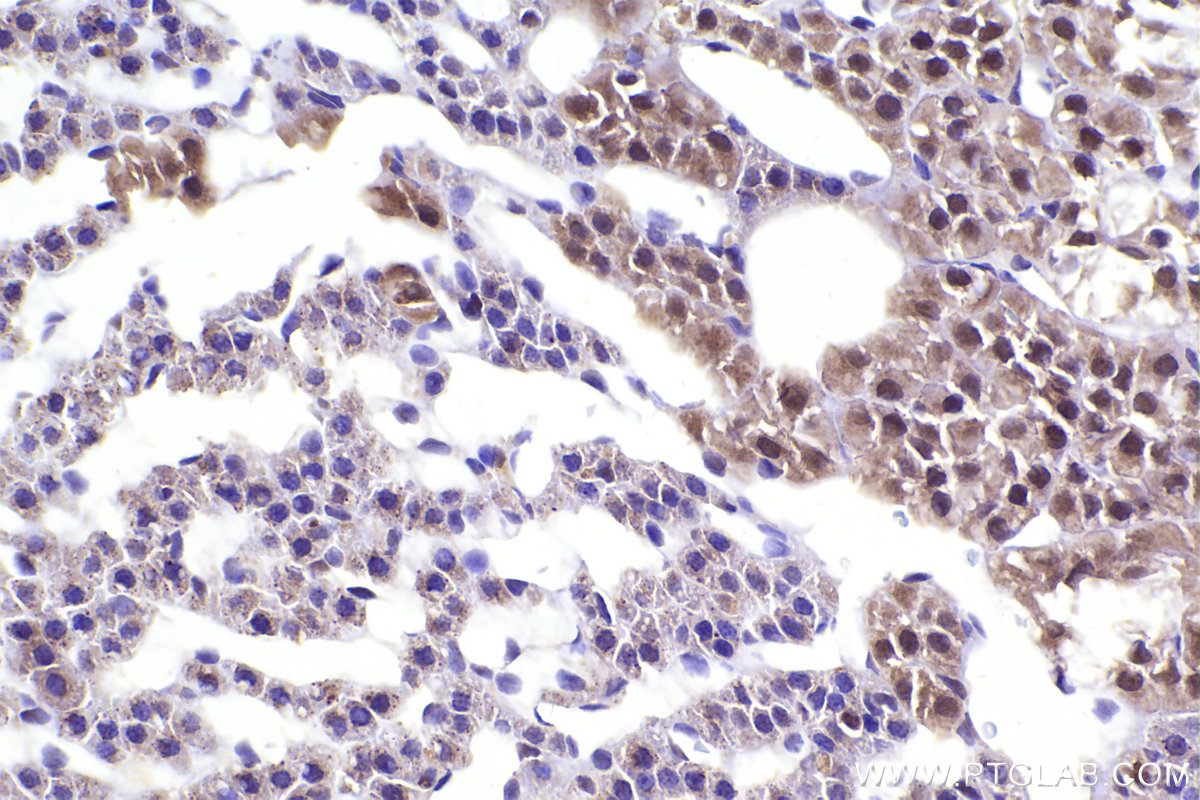 Immunohistochemistry (IHC) staining of rat adrenal gland tissue using APC15 Polyclonal antibody (20409-1-AP)