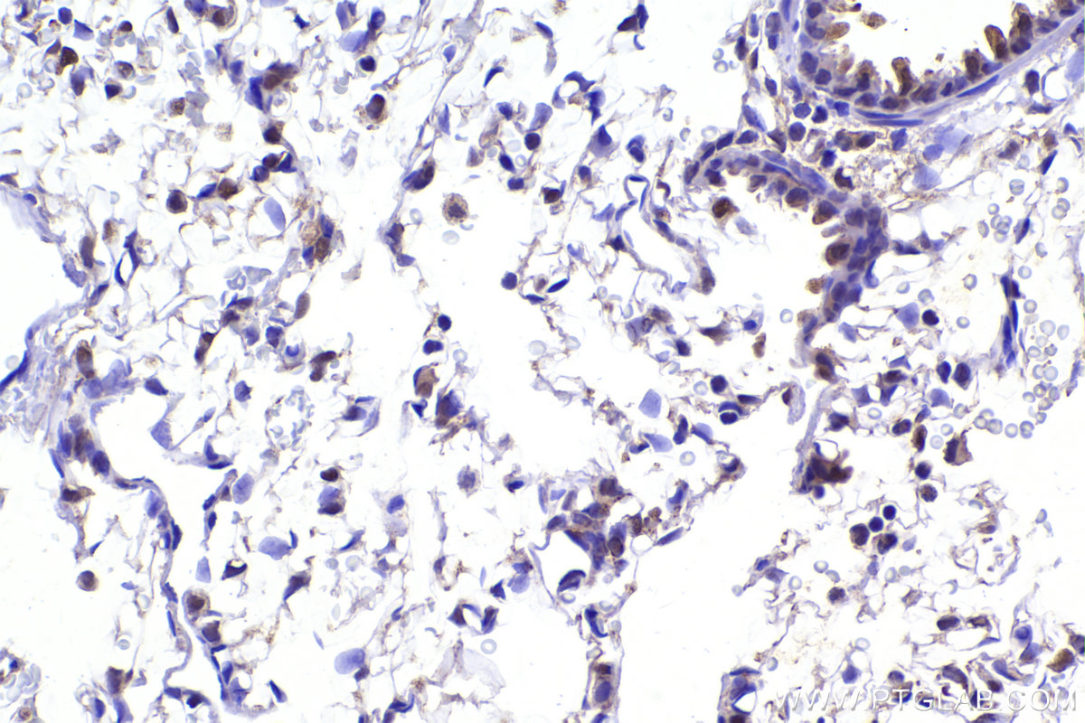 Immunohistochemistry (IHC) staining of rat lung tissue using APC15 Polyclonal antibody (20409-1-AP)