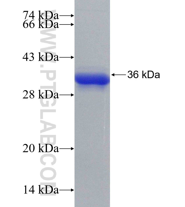 C11orf59 fusion protein Ag31215 SDS-PAGE
