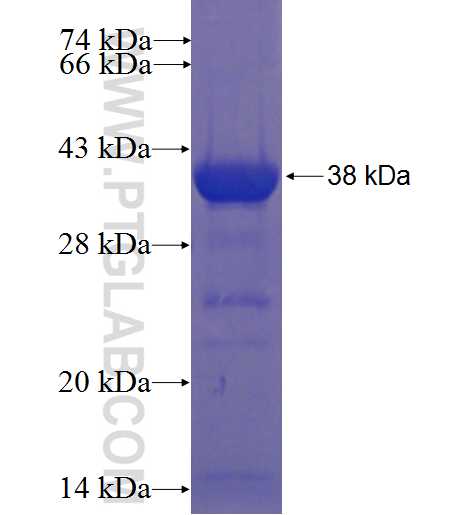 C11orf74 fusion protein Ag22817 SDS-PAGE