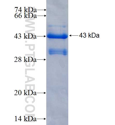 C11orf82 fusion protein Ag26829 SDS-PAGE