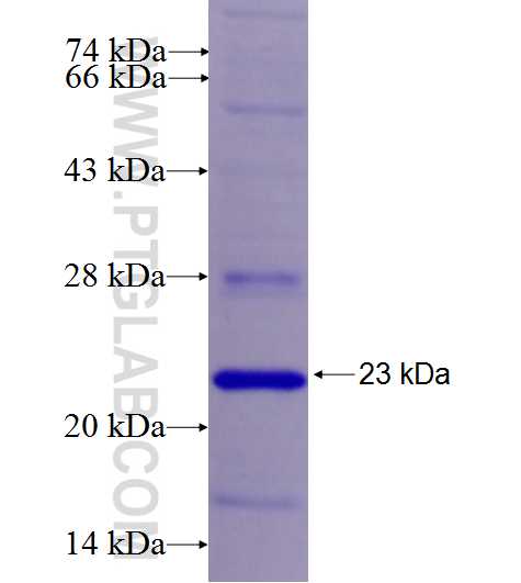 C11orf82 fusion protein Ag26848 SDS-PAGE