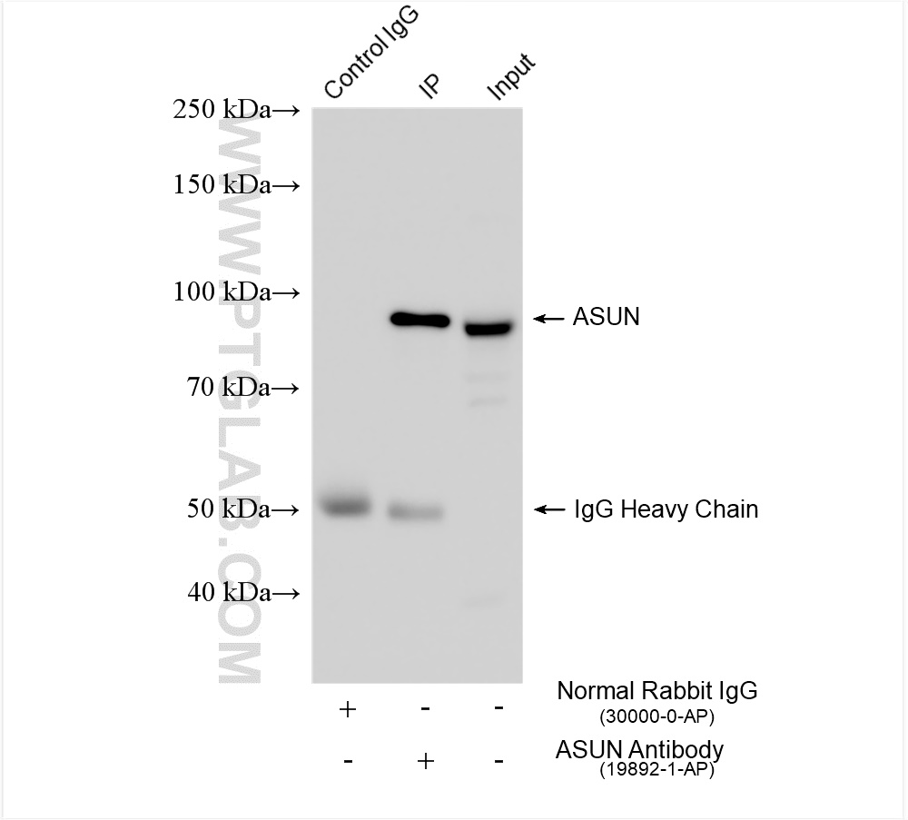 Immunoprecipitation (IP) experiment of MCF-7 cells using ASUN Polyclonal antibody (19892-1-AP)