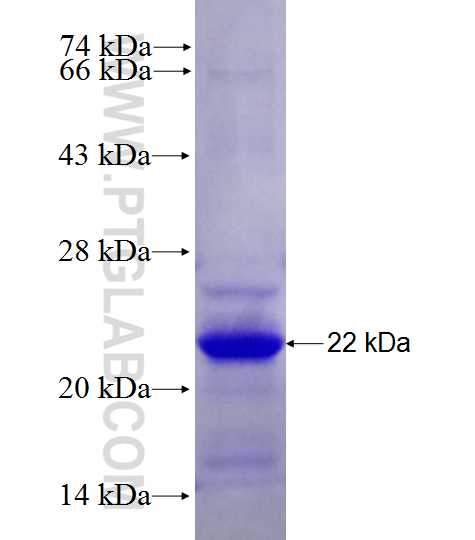 C12orf24 fusion protein Ag27910 SDS-PAGE