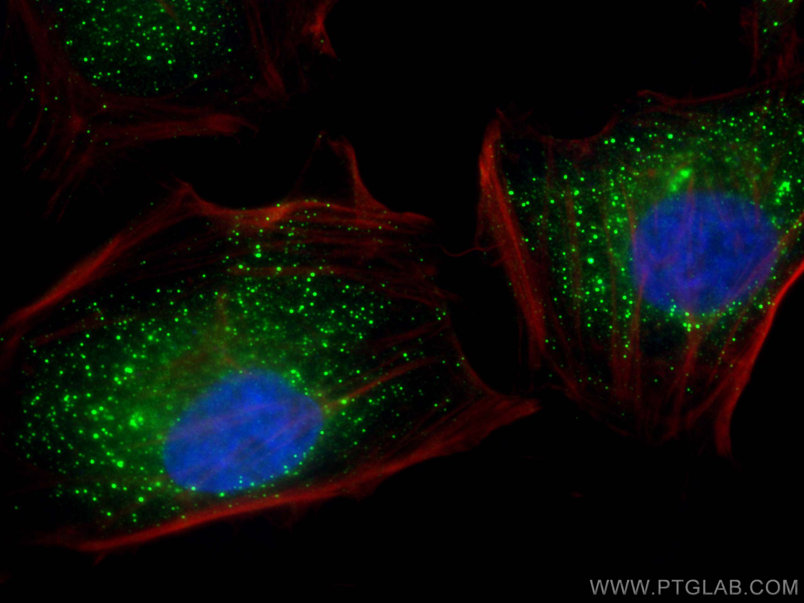 Immunofluorescence (IF) / fluorescent staining of HeLa cells using C12orf29 Polyclonal antibody (31647-1-AP)