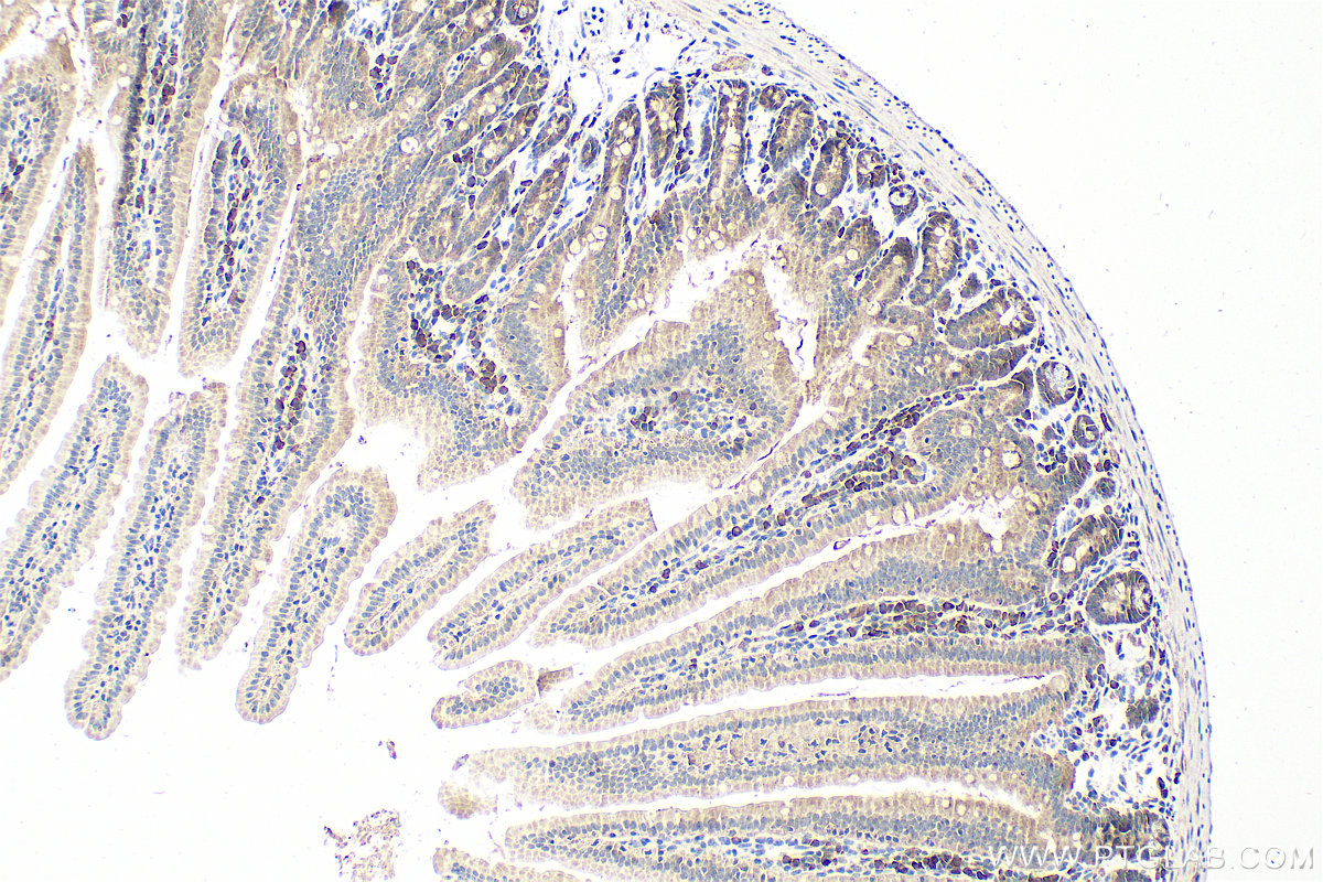 Immunohistochemistry (IHC) staining of mouse small intestine tissue using C12orf29 Polyclonal antibody (31647-1-AP)