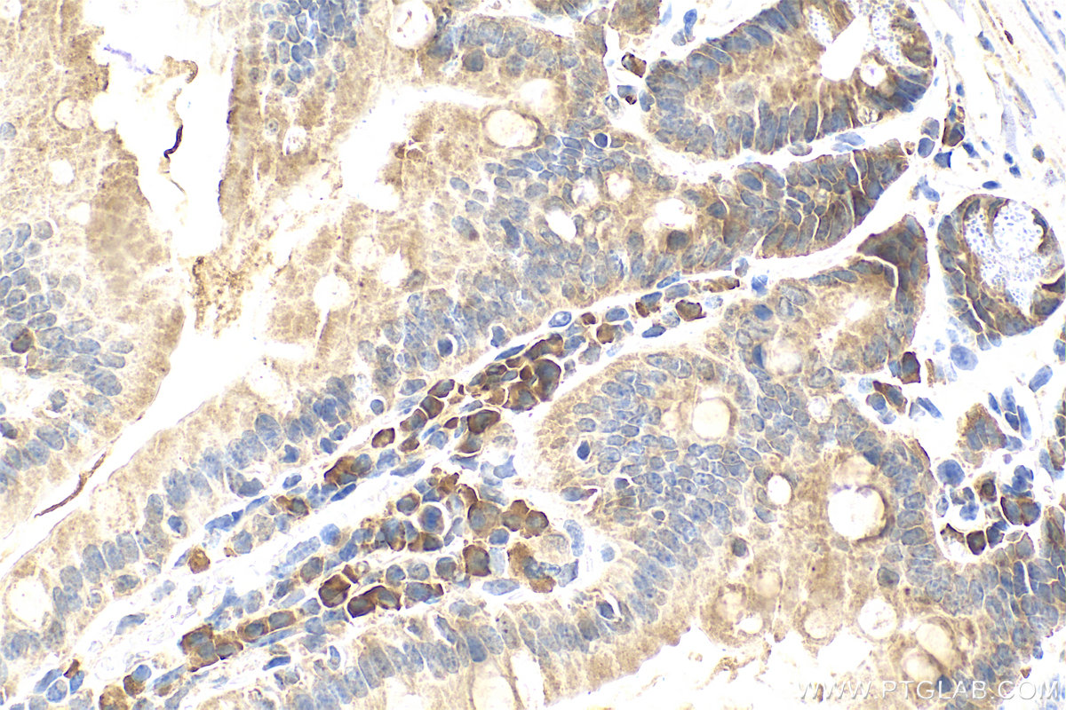 Immunohistochemistry (IHC) staining of mouse small intestine tissue using C12orf29 Polyclonal antibody (31647-1-AP)