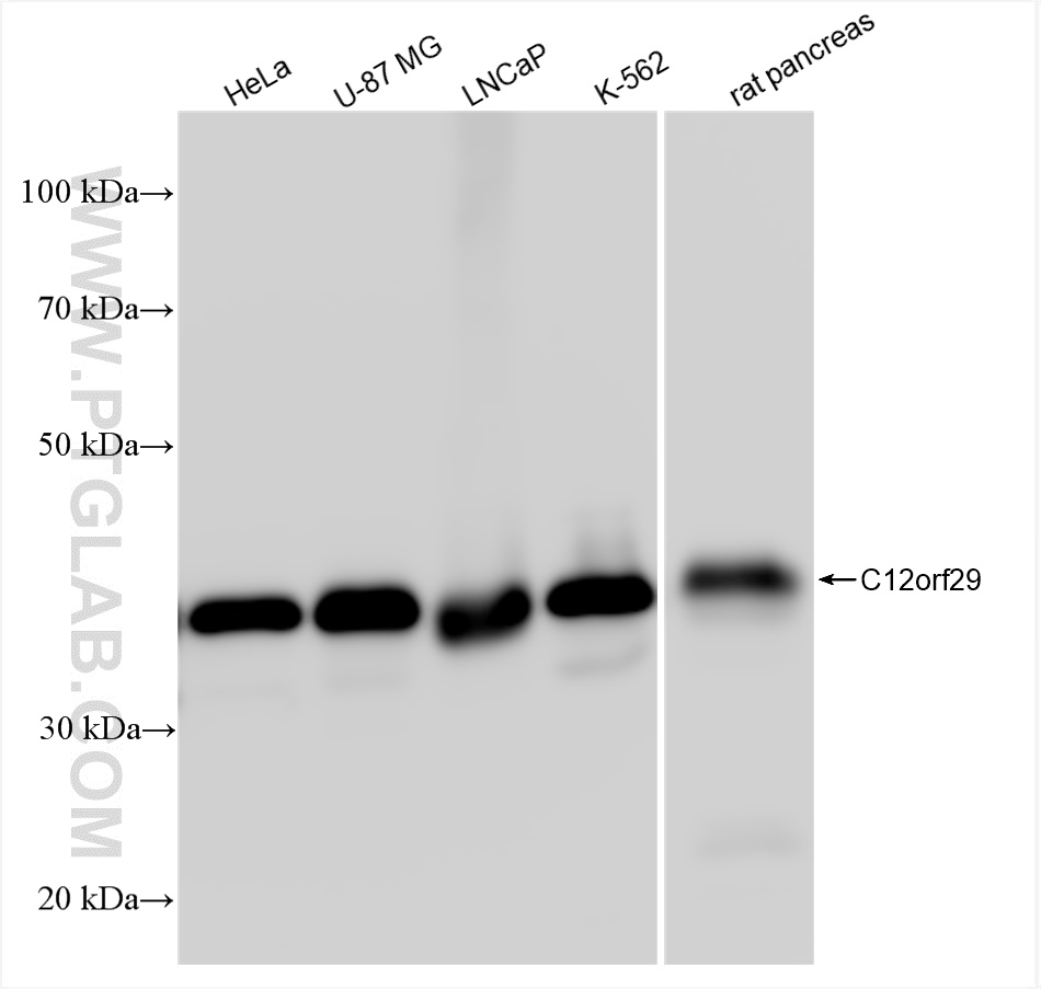 Western Blot (WB) analysis of HeLa cells using C12orf29 Recombinant antibody (84708-1-RR)