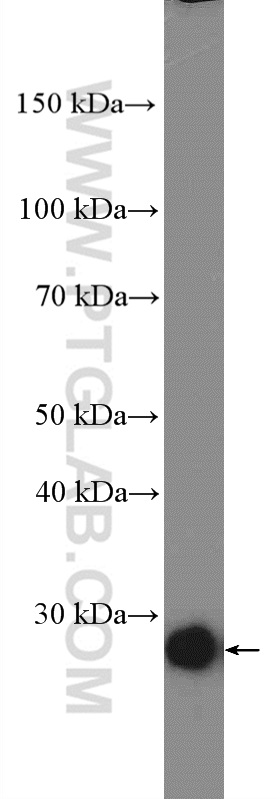 Western Blot (WB) analysis of human testis tissue using C13orf27/TEX30 Polyclonal antibody (25408-1-AP)