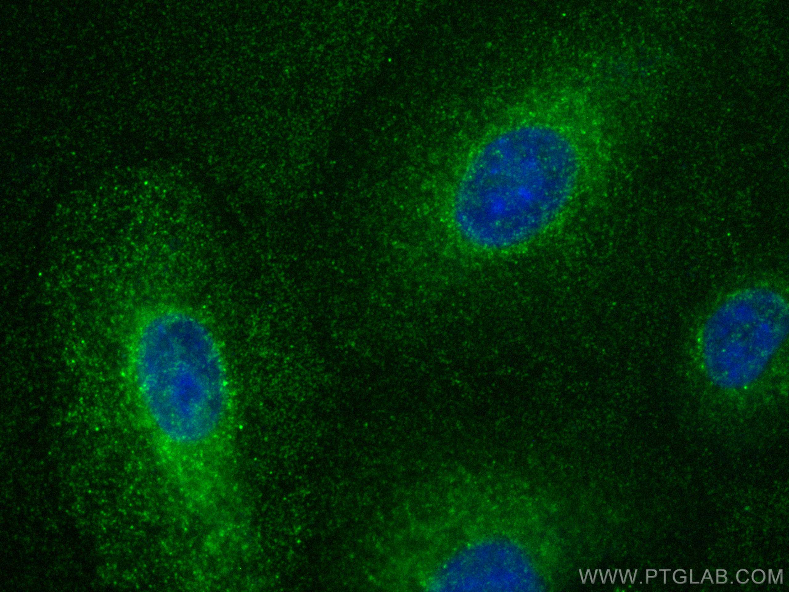 Immunofluorescence (IF) / fluorescent staining of A549 cells using C14orf126 Polyclonal antibody (23923-1-AP)