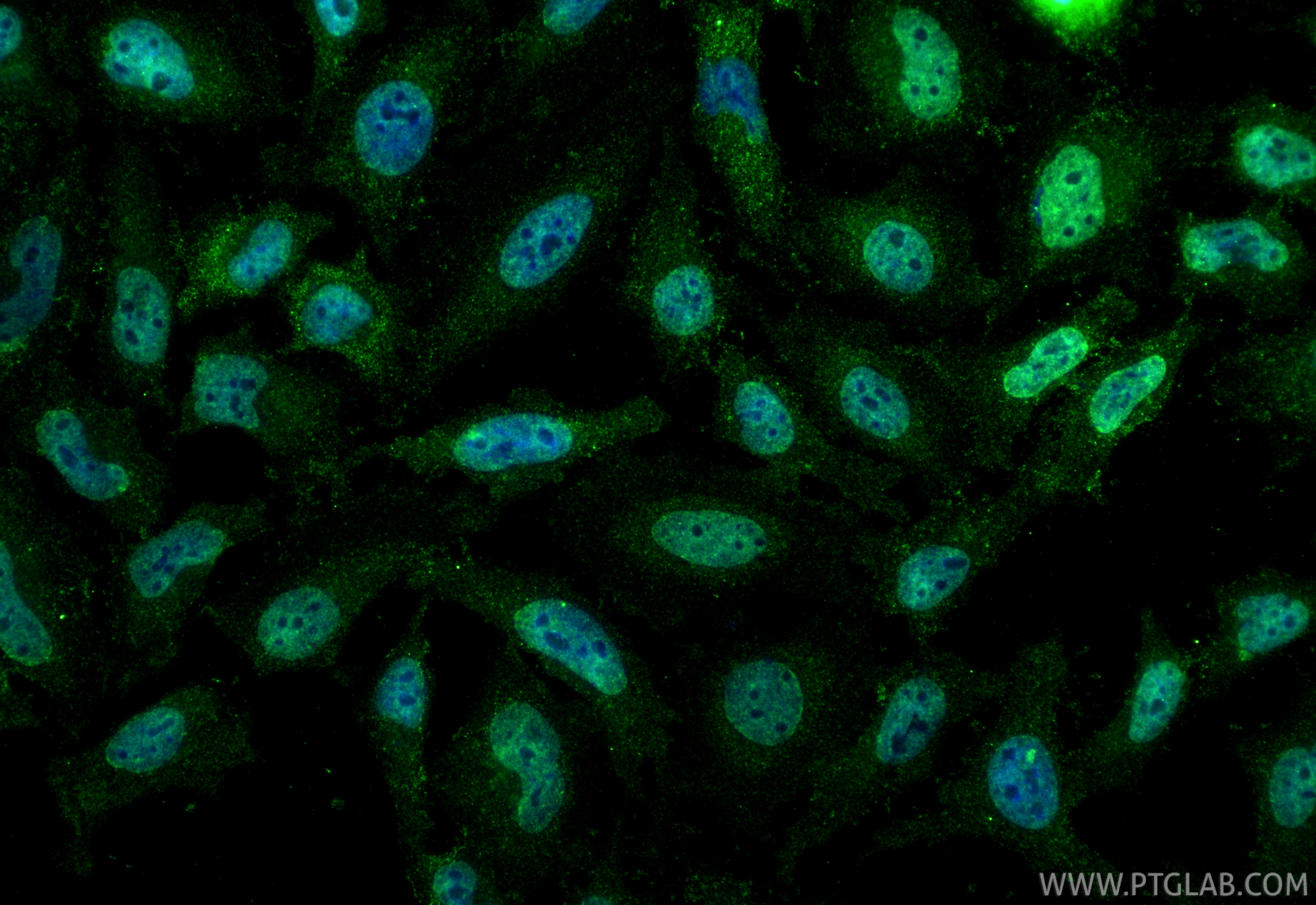 Immunofluorescence (IF) / fluorescent staining of HeLa cells using Nesprin 3 Monoclonal antibody (68420-1-Ig)