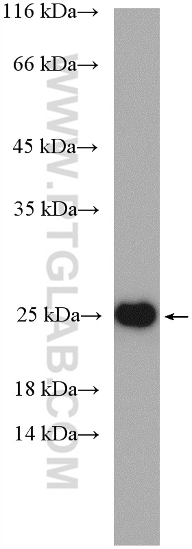 EMC7/C15orf24