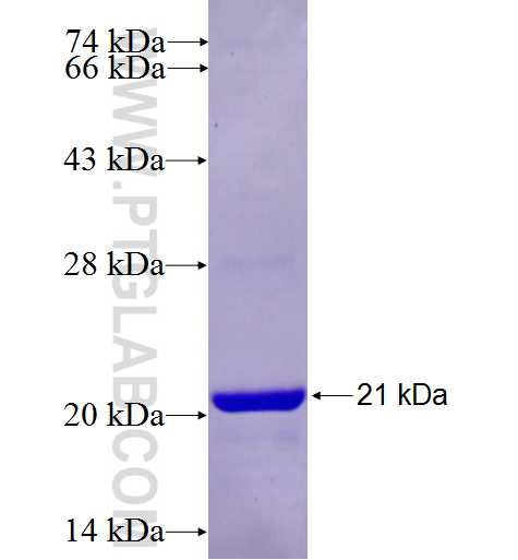 C15orf24 fusion protein Ag26813 SDS-PAGE