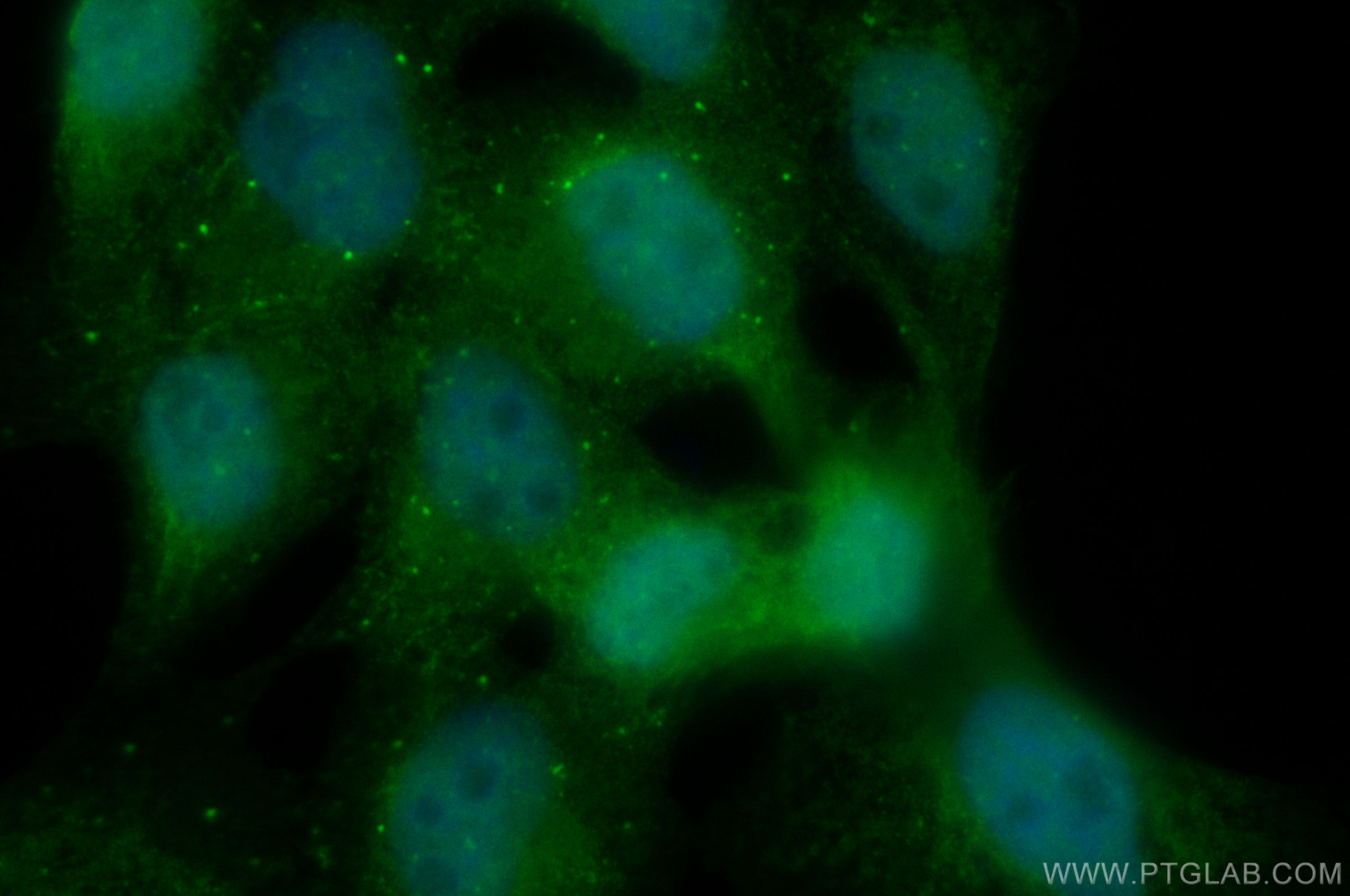 Immunofluorescence (IF) / fluorescent staining of A431 cells using C15orf42 Polyclonal antibody (30664-1-AP)